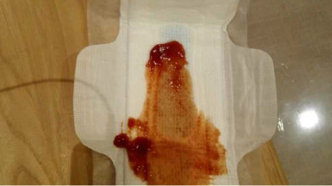 夜用卫生巾带血图片图片