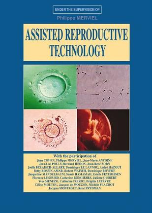 assistedreproductivetechnology