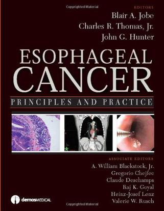 esophageal cancer