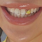 琉璃鲸