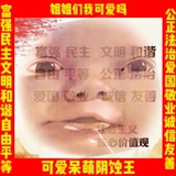 米里（阴蚀王版