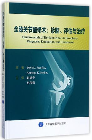 全膝关节翻修术--诊断评估与治疗(精)