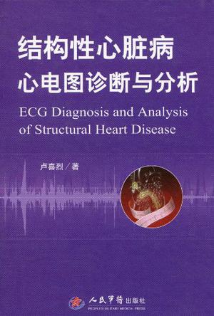 结构性心脏病心电图诊断与分析